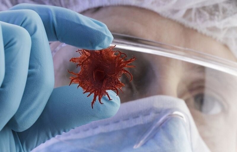 Xərçəng xəstələrinin müalicəsini dövlət edəcək - Gürcüstanda