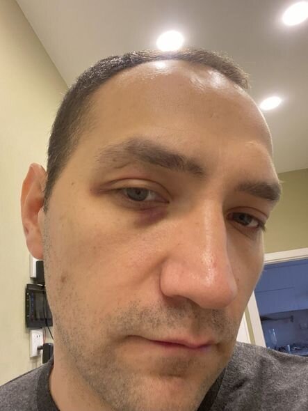 Anastasiyanın ərinin vəkilindən ittihamlara cavab: "Arvadı da bir neçə dəfə ona əl qaldırıb" - FOTO