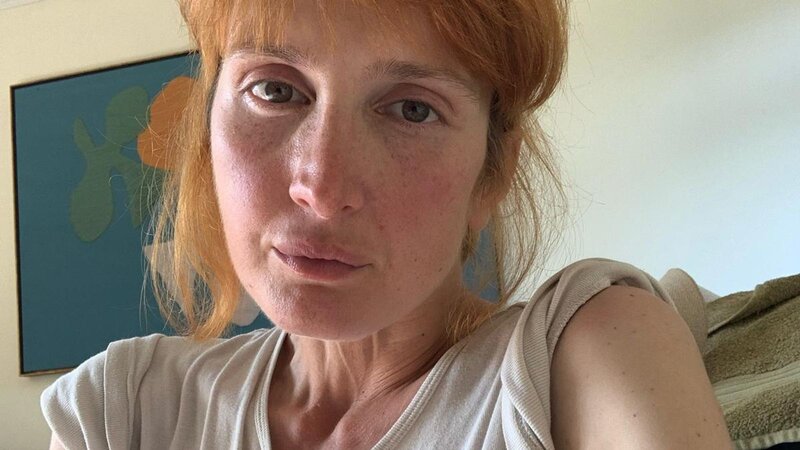 Xərçəngə yoluxan qadını internetdəki üsullarla müalicə AZ QALA ÖLDÜRƏCƏKDİ