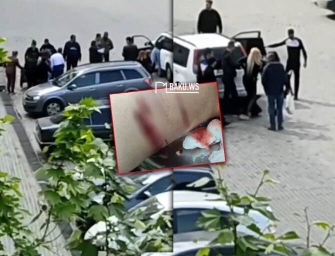 Sahibsiz itlər Xırdalanda sakinə hücum etdilər - FOTO/VİDEO