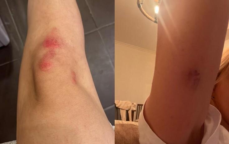 Qadın televiziyada çalışan həyat yoldaşından ŞİKAYƏTÇİDİR: "Məni döyür, işgəncə verir..."