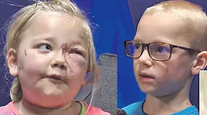 8 yaşlı uşaq balaca bacısını itin hucumdan görün necə XİLAS ETDİ