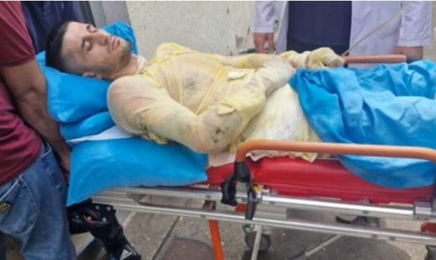 Qız qaçıran qazi özünü yandırıb - TƏFƏRRÜAT - FOTOLAR