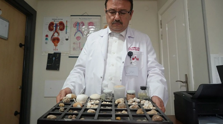 İşi artıq hobbisinə ÇEVRİLİB: 22 ildir xəstələrin böyrək daşlarını YIĞIR - FOTO