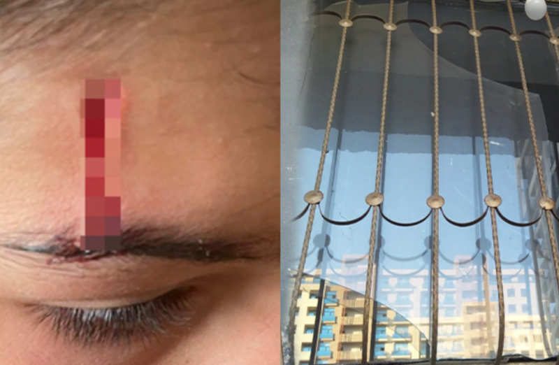 Bakıda təhlükəli vəziyyət: "Bina baxımsızdır, qırıq şüşələr uşaqları yaralayıb"