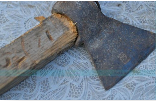 Şərurda ər arvadına balta ilə xəsarət yetirib