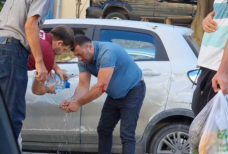 Qadın sürücünü çaşdırdı, maşın aşdı – Video