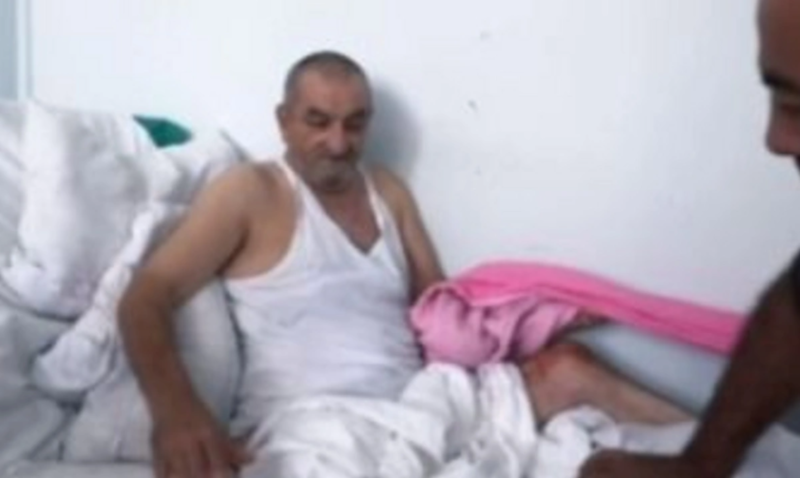 Aktyorun ayağı yanlış amputasiya edilib? Klinikadan AÇIQLAMA