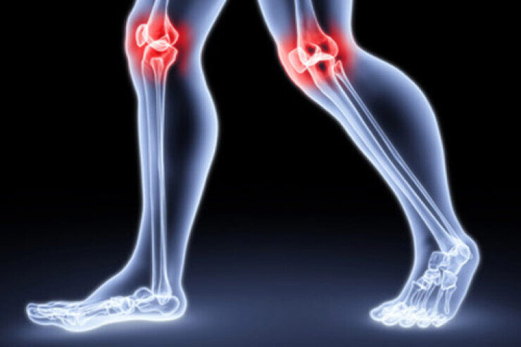 Süni oynaq qoyulmuş şəxslərin həyat tərzi necə olmalıdır? - AÇIQLAMA