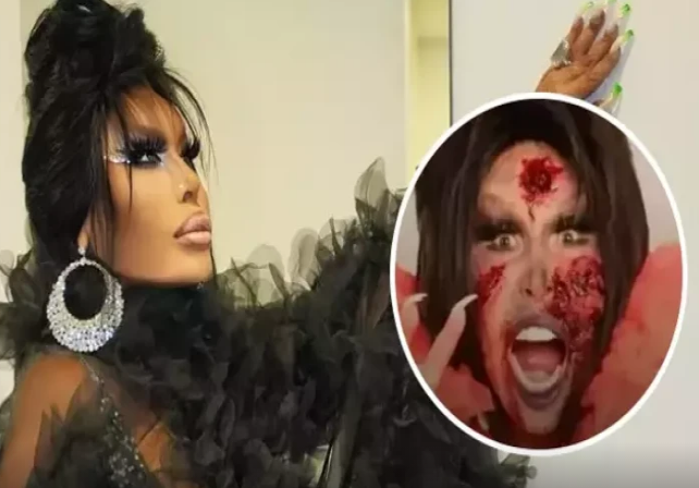 Bülent Ersoy qalaya elə gündə gəldi ki... Hamı ŞOKDA