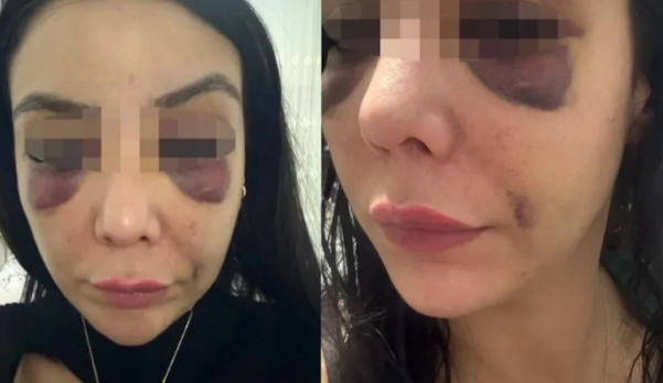 Gənc qadın tualetdə döyüldü