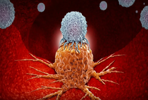 Xərçəngin ən təhlükəli növləri -Nəyi bilməlisiniz