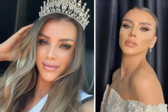 Körpüdən yıxılan avropa gözəlinin üzərindən maşın keçdi