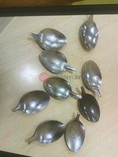 Bakıda bir nəfər 9 ədəd qaşıq uddu (FOTO)