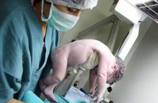 Sumqayıtda evdə doğuş zamanı körpəsi ölən 23 yaşlı qadının vəziyyəti ağırdır