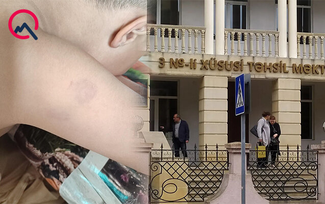 Xüsusi məktəbdə müəllim azyaşlıya şiddət göstərib? - Rəsmi açıqlama - Foto