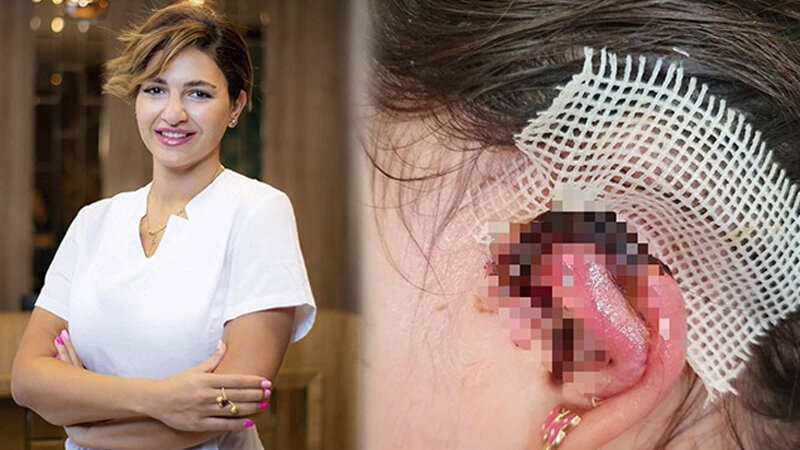 "Həkimin əməliyyatından sonra qızımın qulağında çürümə oldu" (FOTO)