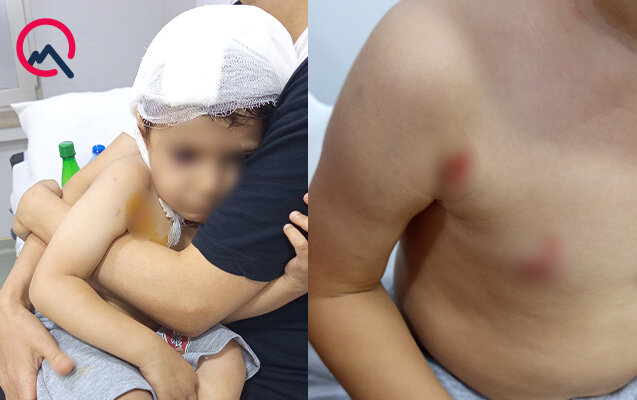 Masazırda 2 yaşlı uşağı it dişlədi - Fotolar