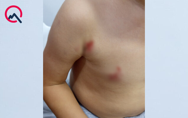 Masazırda 2 yaşlı uşağı it dişlədi - Fotolar