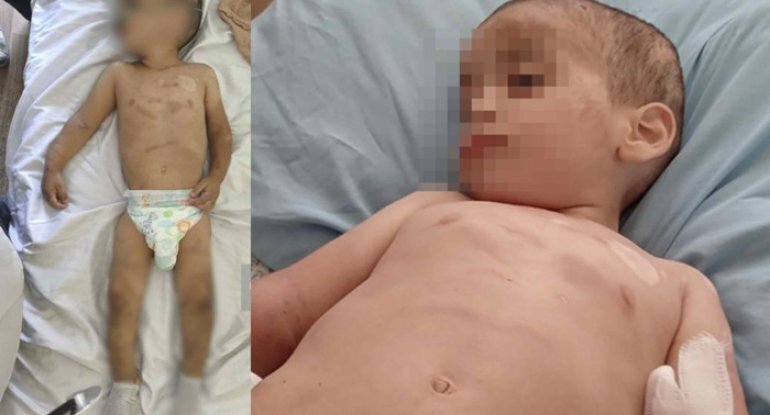 İşgəncə görən uşaqlar valideynlərindən alınacaq? - RƏSMİ - Yenilənib