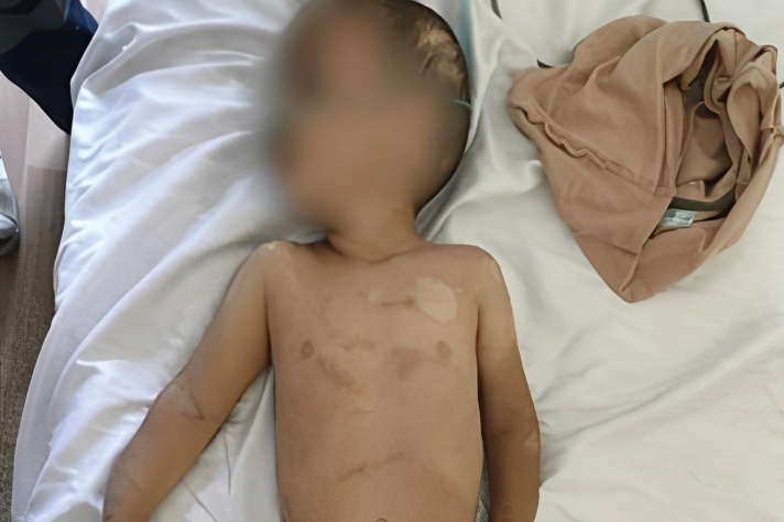 Atası tərəfindən vəhşicəsinə döyülən körpənin anası: "Mənim əl-qolumu bağlamışdı"