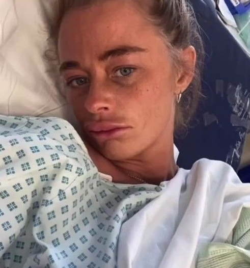 Ziyafət faciəylə nəticələndi: Qadın damdan hovuza tullanarkən üzünü yaraladı - FOTO