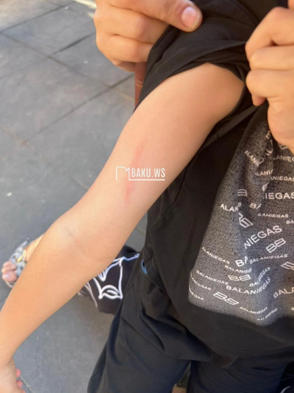 Bağçada dayə tərəfindən uşağa təzyiq göstərilməsi iddiaları TƏSDİQLƏNMƏDİ