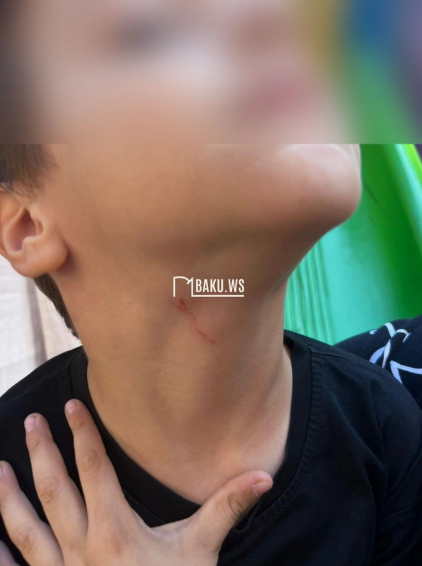 Bağçada dayə tərəfindən uşağa təzyiq göstərilməsi iddiaları TƏSDİQLƏNMƏDİ