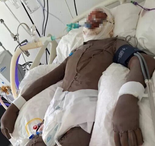 15 yaşlı gənc üzərinə benzin tökülərək yandırıldı - FOTO