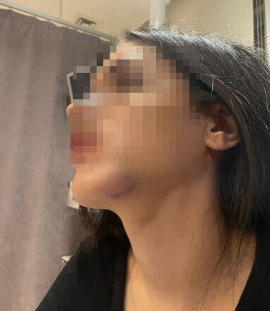 Gənc qız keçmiş sevgilisinin hücumuna məruz qaldı - FOTO