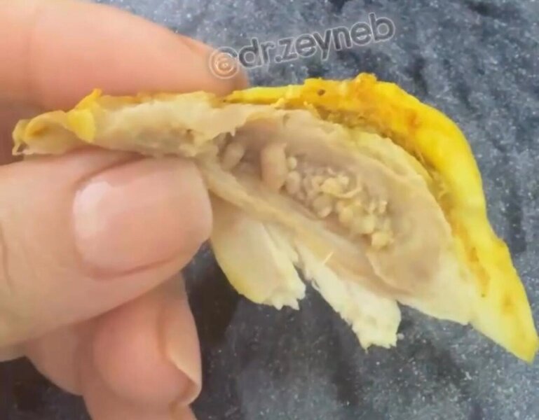 Toyuq ətində gizli TƏHLÜKƏ - Bu hissələri qətiyyən YEMƏYİN