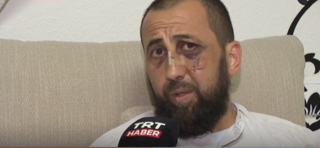 15 polis türk kişini arvadının göz önündə döydü - VİDEO