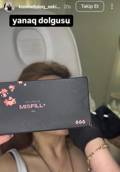 Kosmetoloq Səkinə Zamanova necə inyeksiya, dolğu proseduru həyata keçirir?-Fotofaktlar