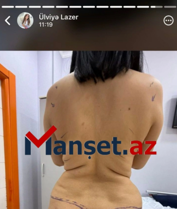 Eltisinin ölümünə səbəb olan həkim iş başında: Müştəri qəbul edir