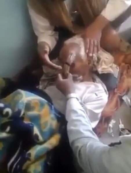 130 yaşlı qoca "buynuz" əməliyyatından sonra ÖLDÜ