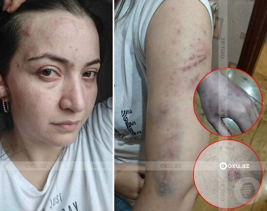 Polis əri tərəfindən şöbədə qətlə yetirilən qadının qardaşı gizlinləri açdı - FOTO