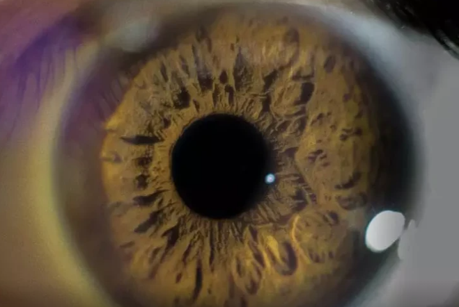 Gözündən süd axdı:İlker Yılmaz niyə Ginnesin Rekordlar Kitabına düşüb?