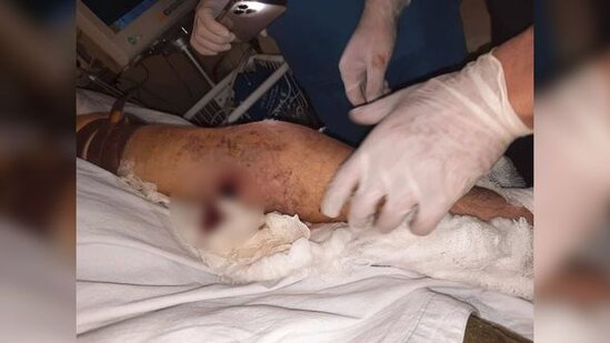 Ermənilərin açdığı atəş nəticəsində "Azercell"in əməkdaşı yaralanıb – FOTO