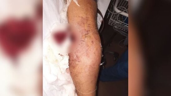 Ermənilərin açdığı atəş nəticəsində "Azercell"in əməkdaşı yaralanıb – FOTO