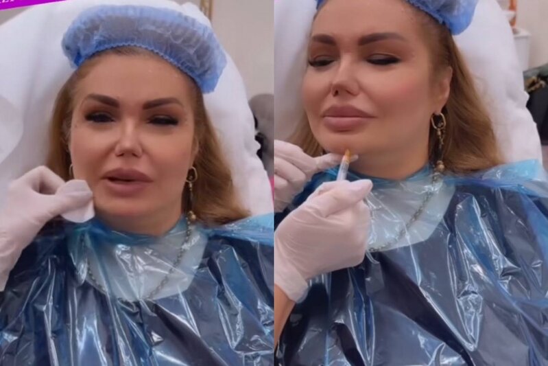 Könül Kərimovadan plastik əməliyyat iddiasına CAVAB