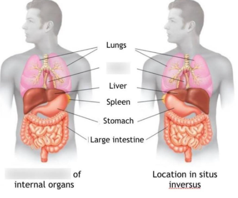 Bu adamın qaraciyəri solda, ürəyi sağdadır - FOTOlar
