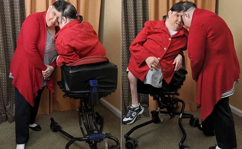 Dünyanın ən yaşlı siam əkizləri vəfat etdi