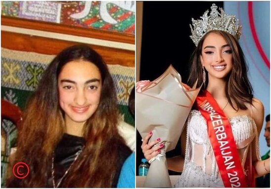 Satılan gözəllik və ya plastik cərrahların əl işi