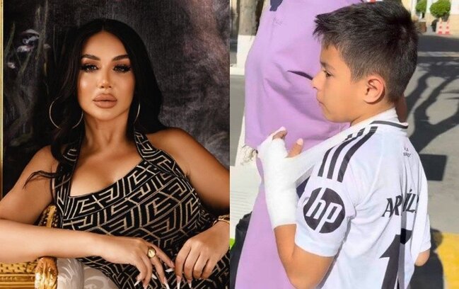 Lətifənin oğlu zədələndi - Foto