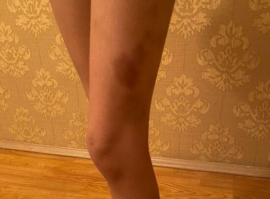 Narkoman ananın sevgilisi uşaqları DÖYDÜ -FOTO