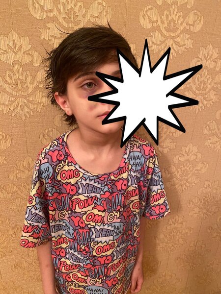 Narkoman ananın sevgilisi uşaqları DÖYDÜ -FOTO