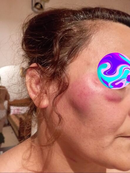 Qaradağda kişinin döyüb evdən qovduğu arvadı əmisi qızı imiş - YENİLƏNİB + FOTO