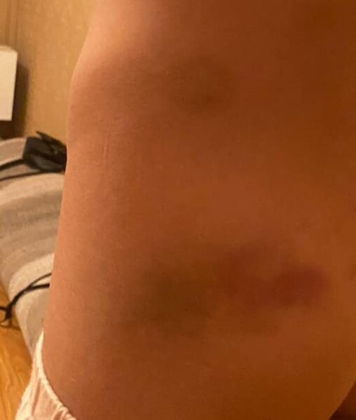 Narkoman ananın sevgilisi uşaqları DÖYDÜ -FOTO