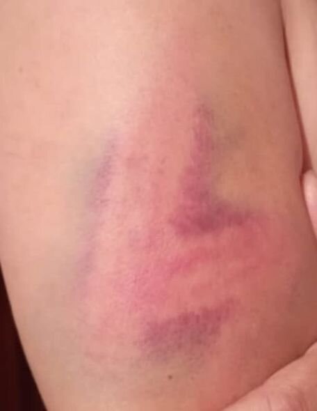 Qaradağda kişinin döyüb evdən qovduğu arvadı əmisi qızı imiş - YENİLƏNİB + FOTO