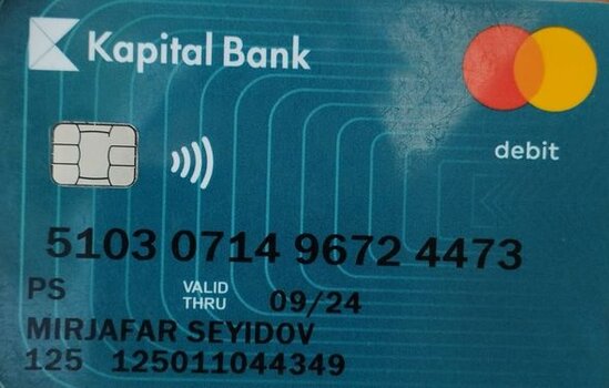 İki yaşlı Mirsəccadın başında şiş aşkarlanıb - FOTO